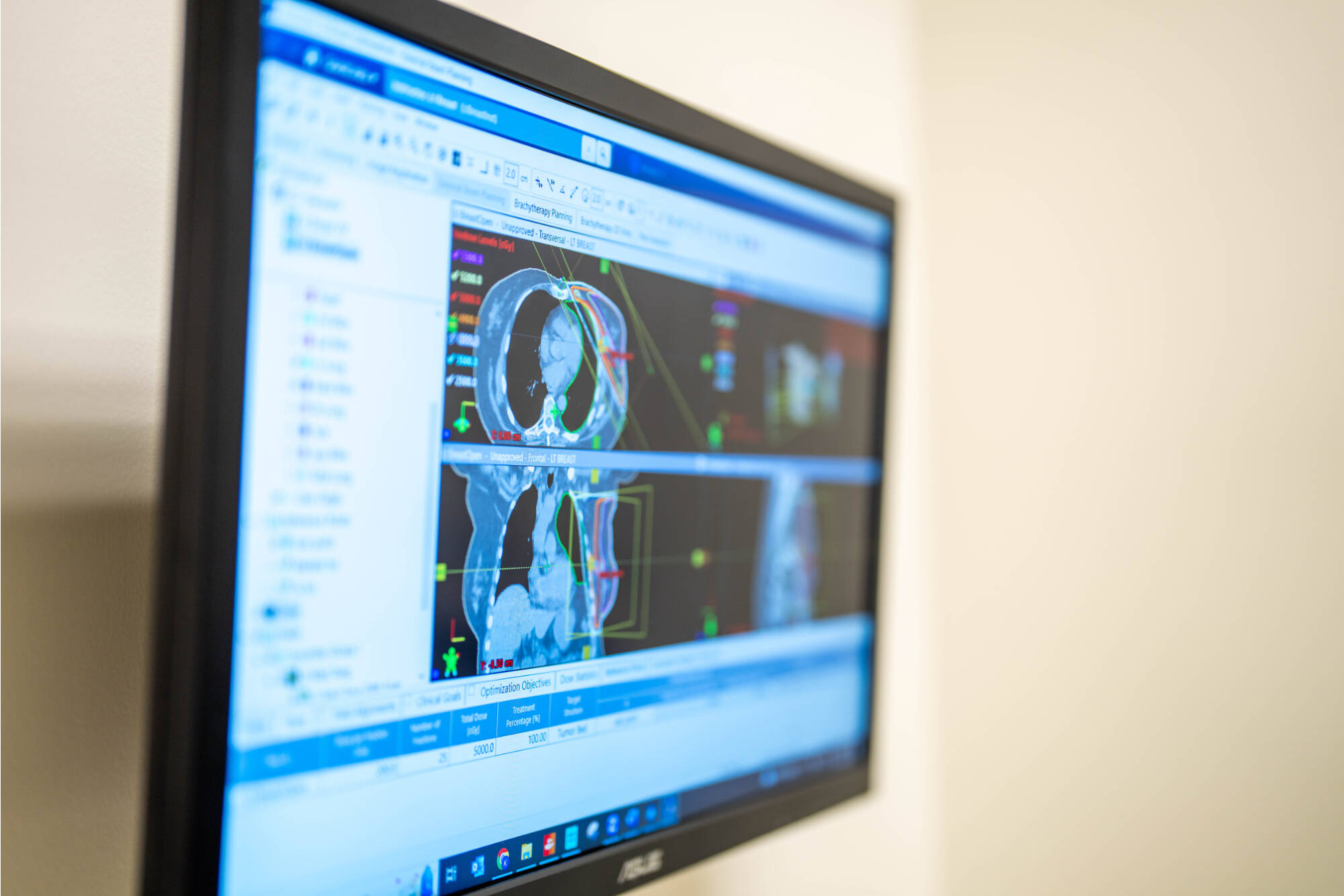 A monitor displays health information